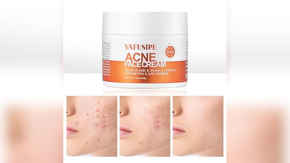 Best Skin Care Products for Pcos